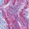 Masson Trichrome (Methyl Blue) Stain Kit