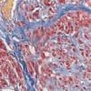 Picro Mallory Trichrome Stain Kit