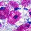 ZN Stain Kit, Methylene Blue